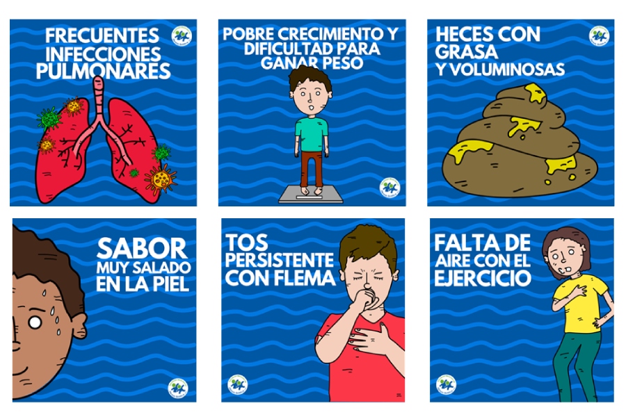 Gráfico: principales síntomas fibrosis quística: Frecuentes infecciones pulmonares, dificultad de crecimiento, sabor muy salado en la piel, tos persistente, falta de aire con ejercicio.
